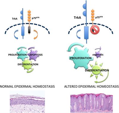 p75 Neurotrophin Receptor in the Skin: Beyond Its Neurotrophic Function